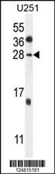 GGTLC2 Antibody
