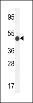GCNT2 Antibody