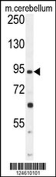 GABBR2 Antibody