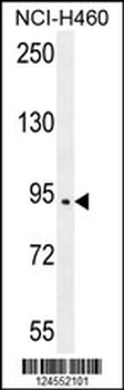 SPARCL1 Antibody