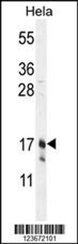 CLDN7 Antibody