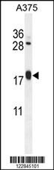 ARL8A Antibody