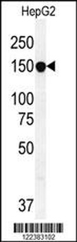 ABCC10 Antibody