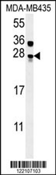 BLOC1S5 Antibody