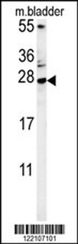 BLOC1S5 Antibody