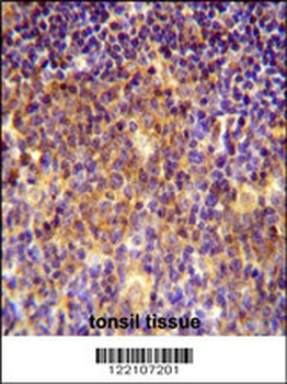 BLOC1S5 Antibody