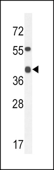 ADH4 Antibody