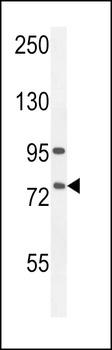 ALOX12B Antibody