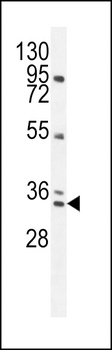 BCA3 Antibody