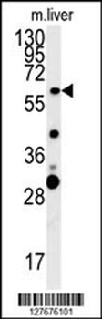 ZCCHC5 Antibody
