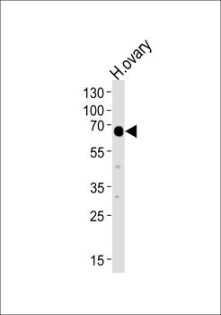 POTEB Antibody