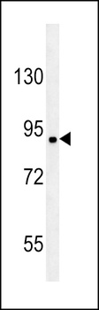 CCSER1 Antibody