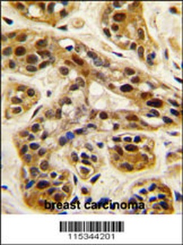 PRMT1 Antibody