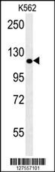 POTEE Antibody