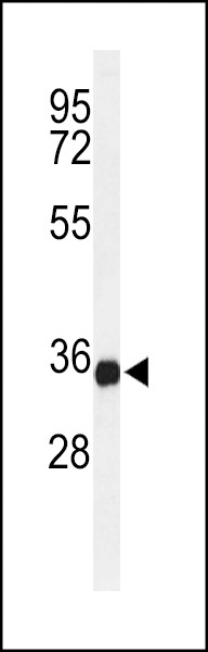 TMEM173 Antibody