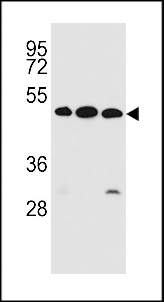 KREMEN2 Antibody