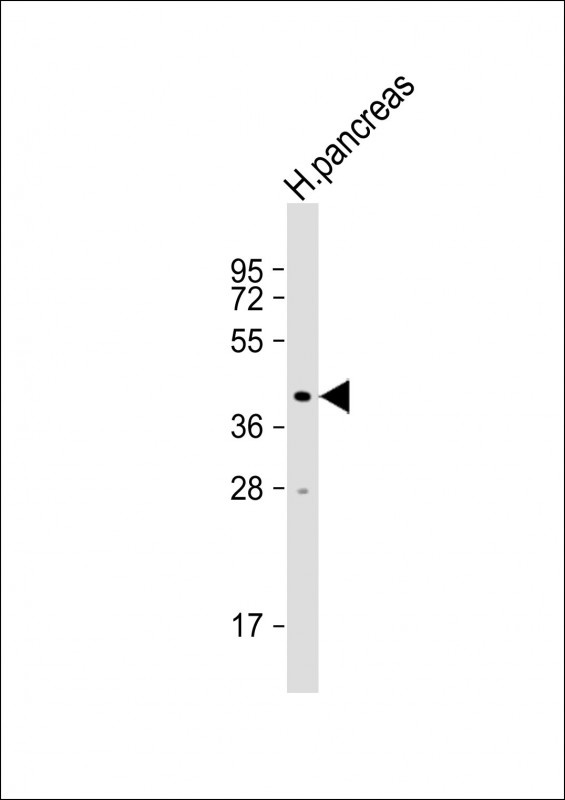 NPTX2 Antibody