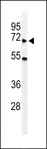 YTHDF3 Antibody