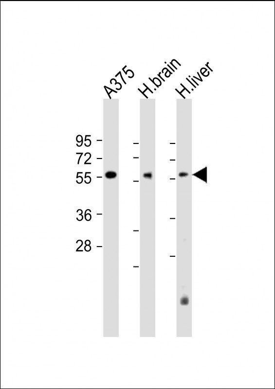 DLL3 Antibody