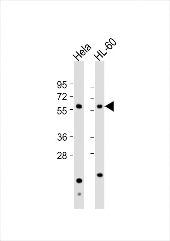 Natriuretic Peptide Receptor C Antibody