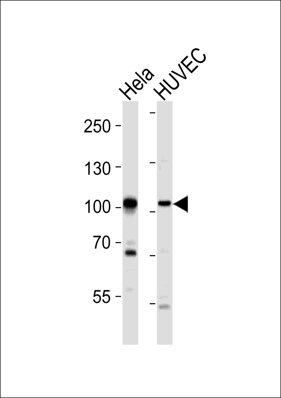 EPHA4 Antibody