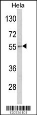 DFNA5 Antibody