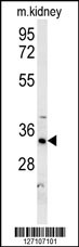 HSD17B13 Antibody