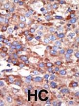 YY1 Antibody