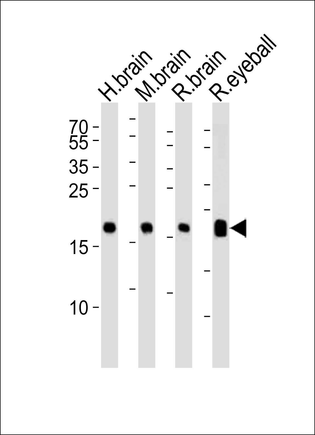 VSNL1 Antibody