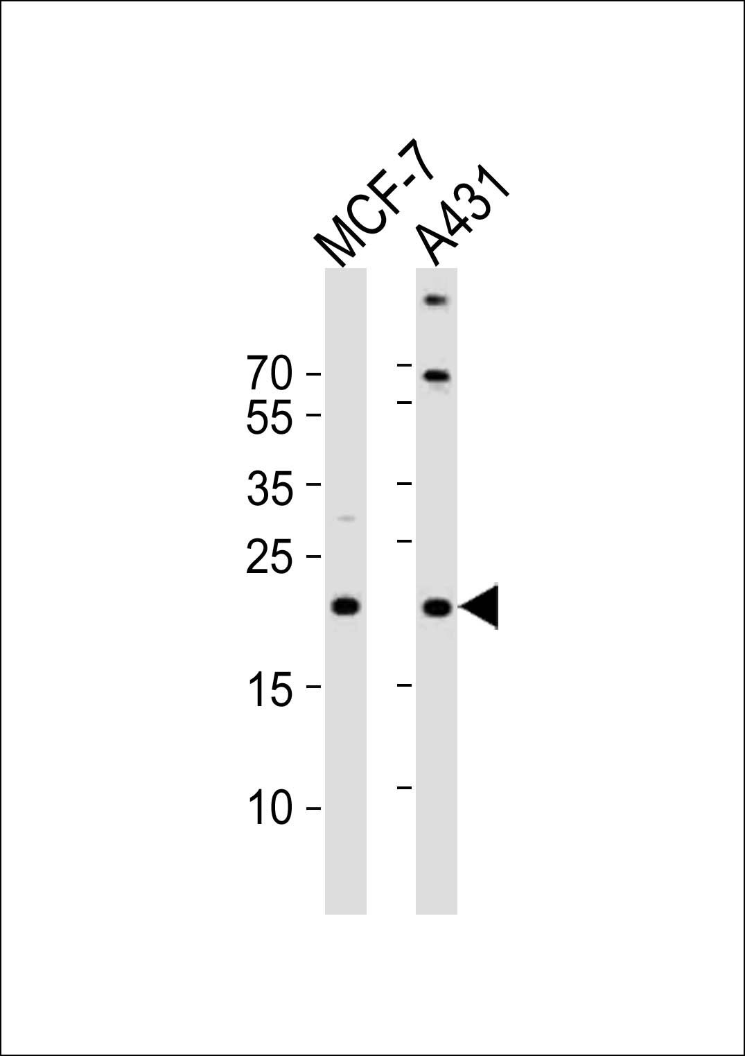 TIMM23 Antibody