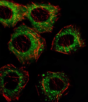 FADS2 Antibody