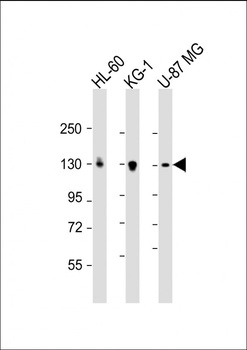 DEPDC5 Antibody