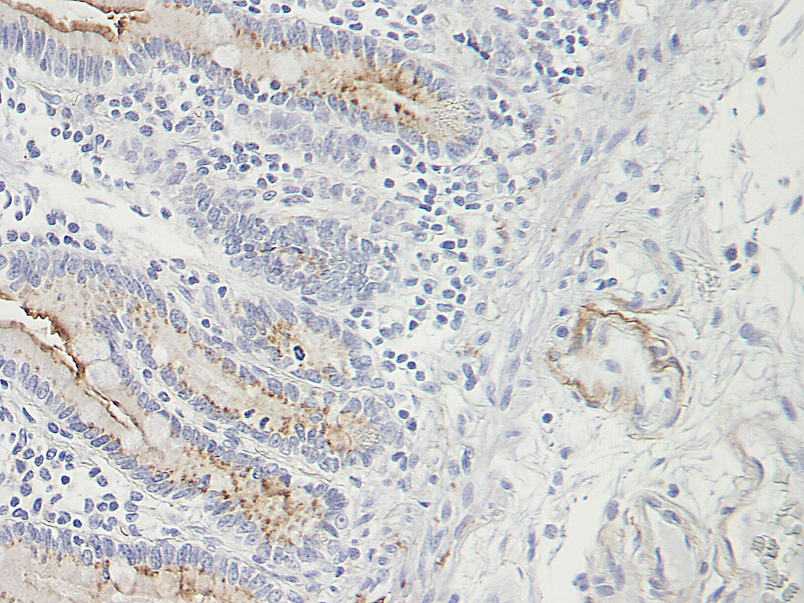 CCL25 Antibody