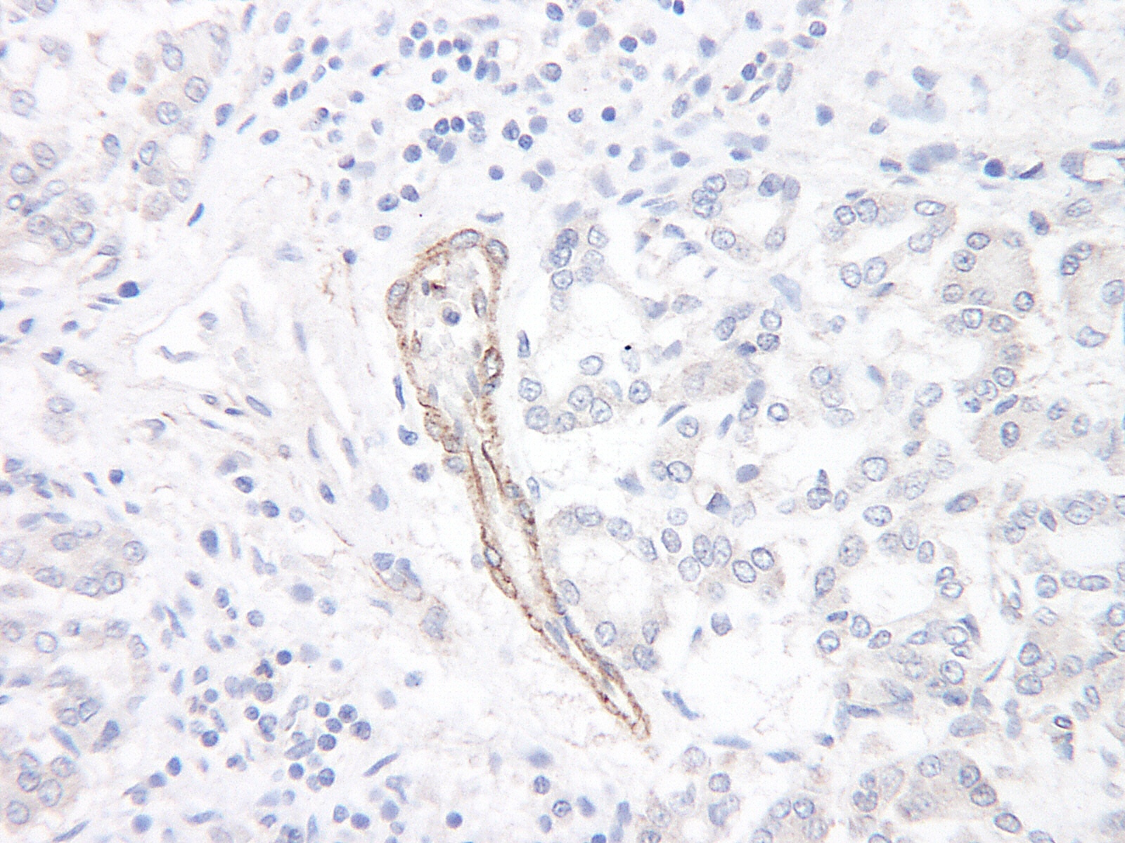 CCL1 Antibody