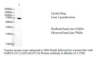 SARS-CoV-2 (COVID-19) S2 Protein polyclonal antibody