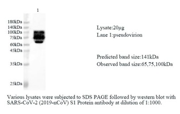 SSARS-CoV-2 COVID-19) S1 Protein polyclonal antibody