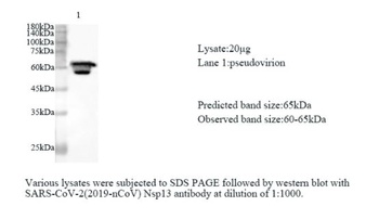 SARS-CoV-2 (COVID-19) Nsp13 polyclonal antibody