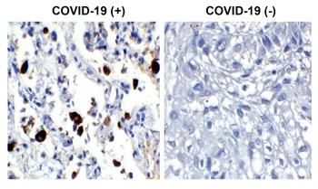 SARS-CoV-2 (COVID-19) Nucleocapsid Antibody [3866]