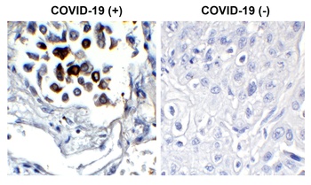 SARS-CoV-2 (COVID-19) Nucleocapsid Antibody [3865]