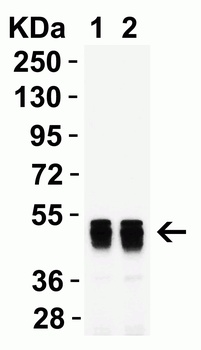 SARS-CoV-2 (COVID-19) Nucleocapsid Antibody [3864]