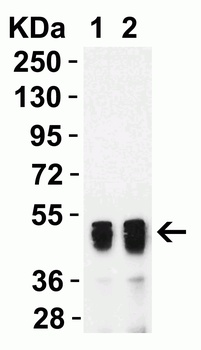SARS-CoV-2 (COVID-19) Nucleocapsid Antibody [3862]
