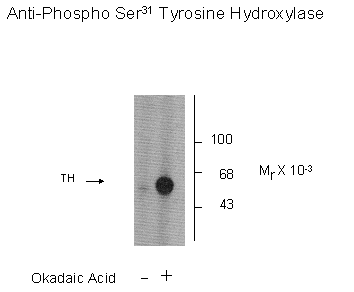 Tyrosine Hydroxylase (phospho Ser31) Antibody