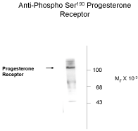 Progesterone Receptor (phospho Ser190) Antibody [1154]