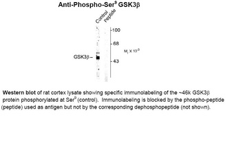 Gsk3b Antibody