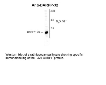 Ppp1r1b Antibody