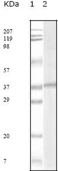 KSHVORF62 Antibody [5B7B6]