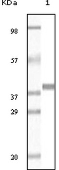 GSTP1 Antibody