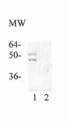 JNK/SAPK (phospho Thr183 / Tyr185) Antibody