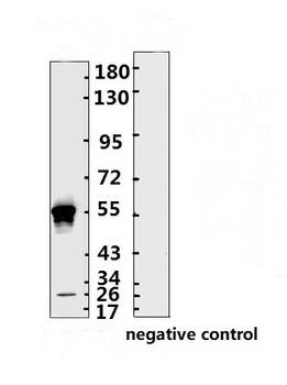 SARS-CoV-2 (COVID-19) Nucleocapsid Monoclonal Antibody [N001]