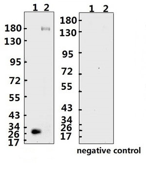 SARS-CoV-2 (COVID-19) Spike ECD Monoclonal Antibody [B005]